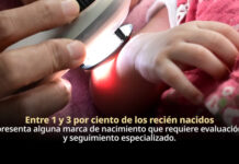 Marcas de nacimiento requieren valoración médica para identificar riesgos y brindar tratamiento adecuado