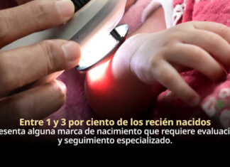 Marcas de nacimiento requieren valoración médica para identificar riesgos y brindar tratamiento adecuado